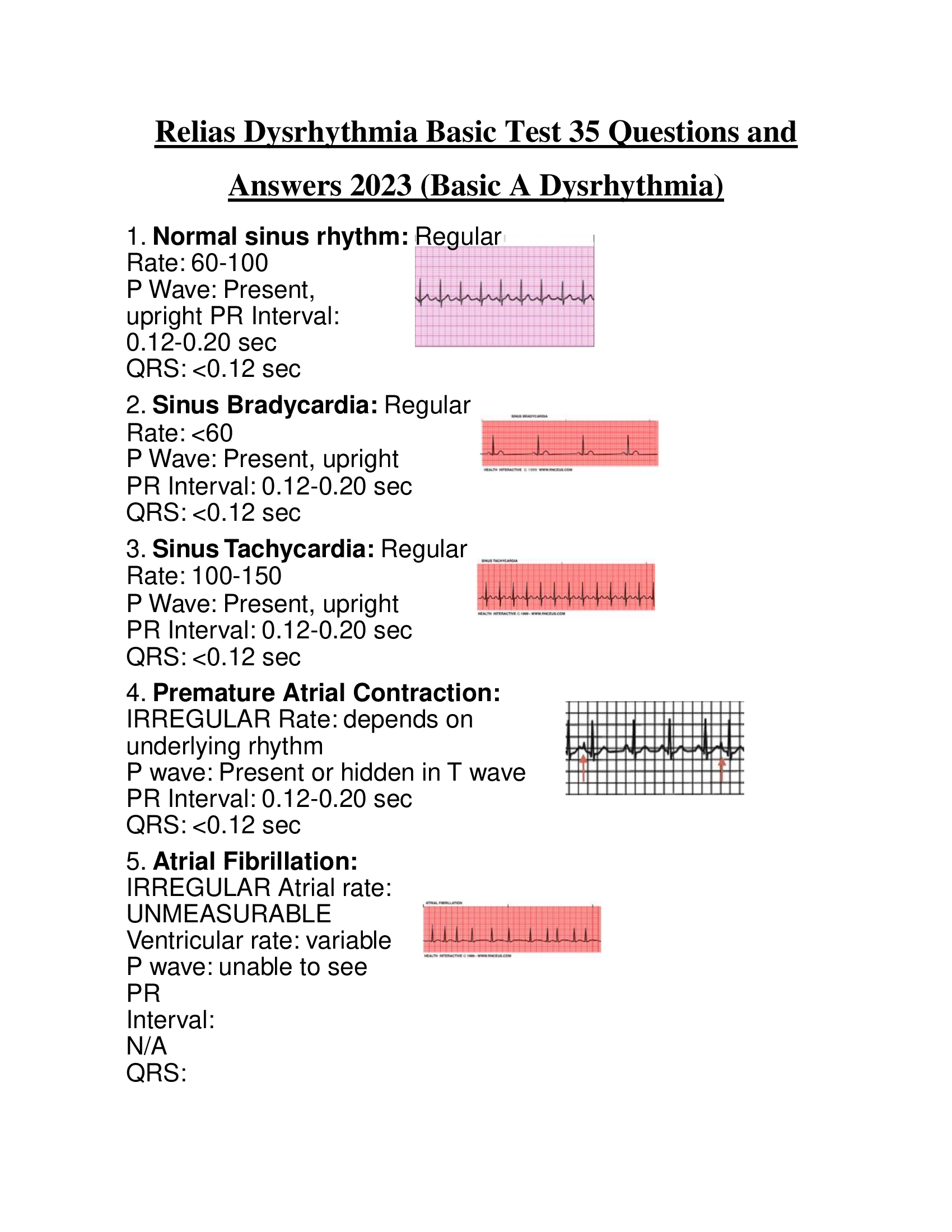 Relias Dysrhythmia Basic Test 35 Questions and Answers 2023 (Basic A Dysrhythmia)