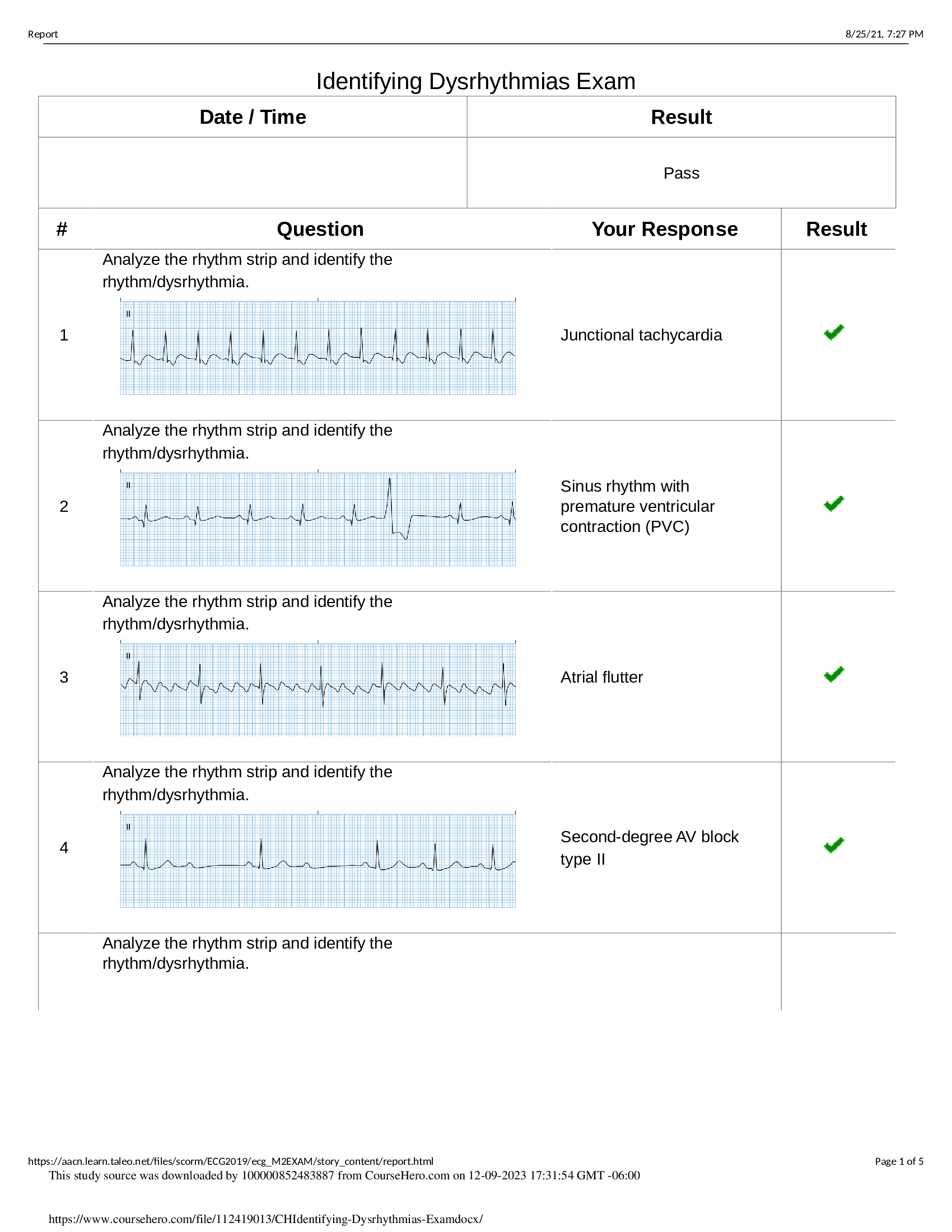 Identifying Dysrhythmias Exam Answers