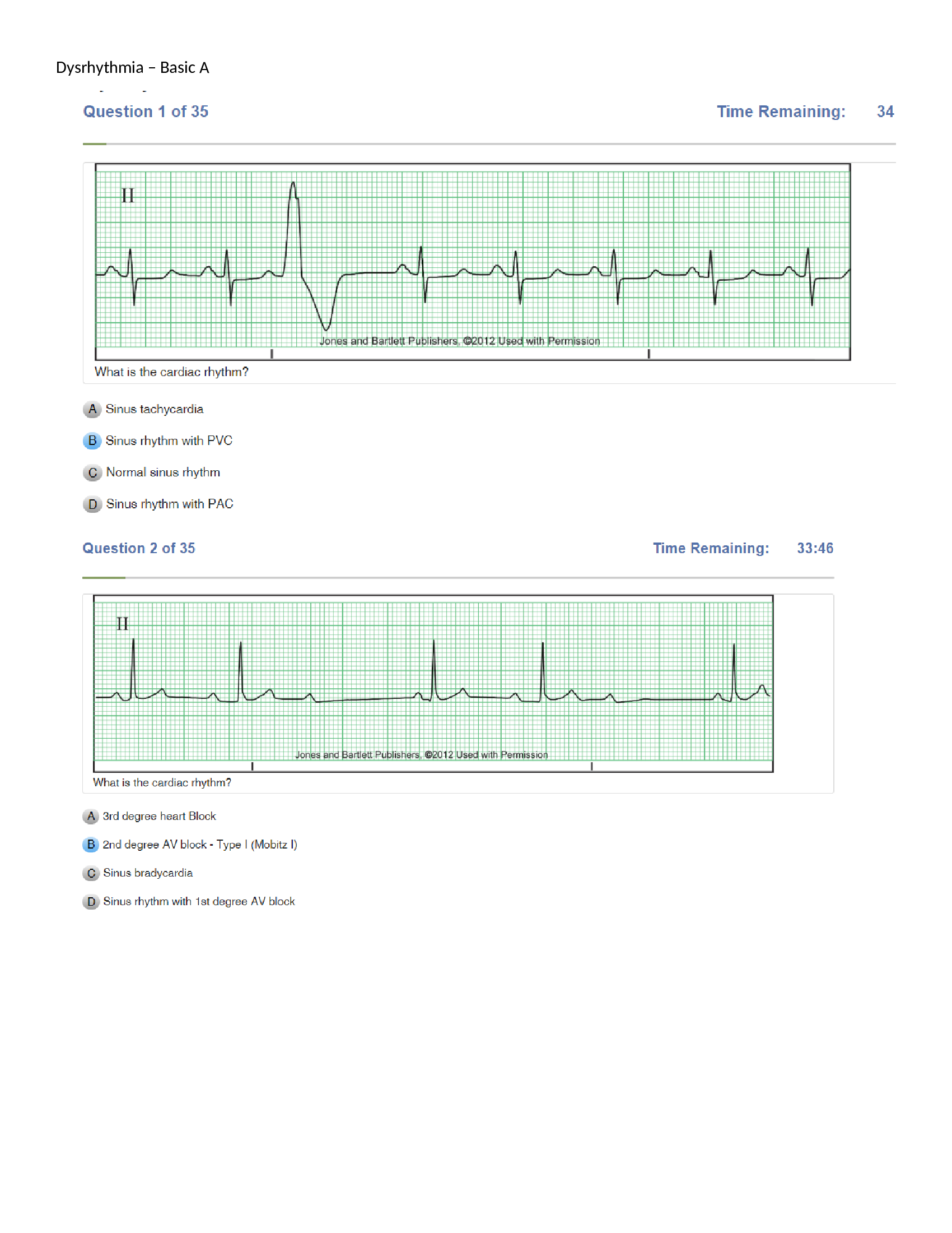 Relias Dysrhythmia Basic Test Answers Solution guide 2023.