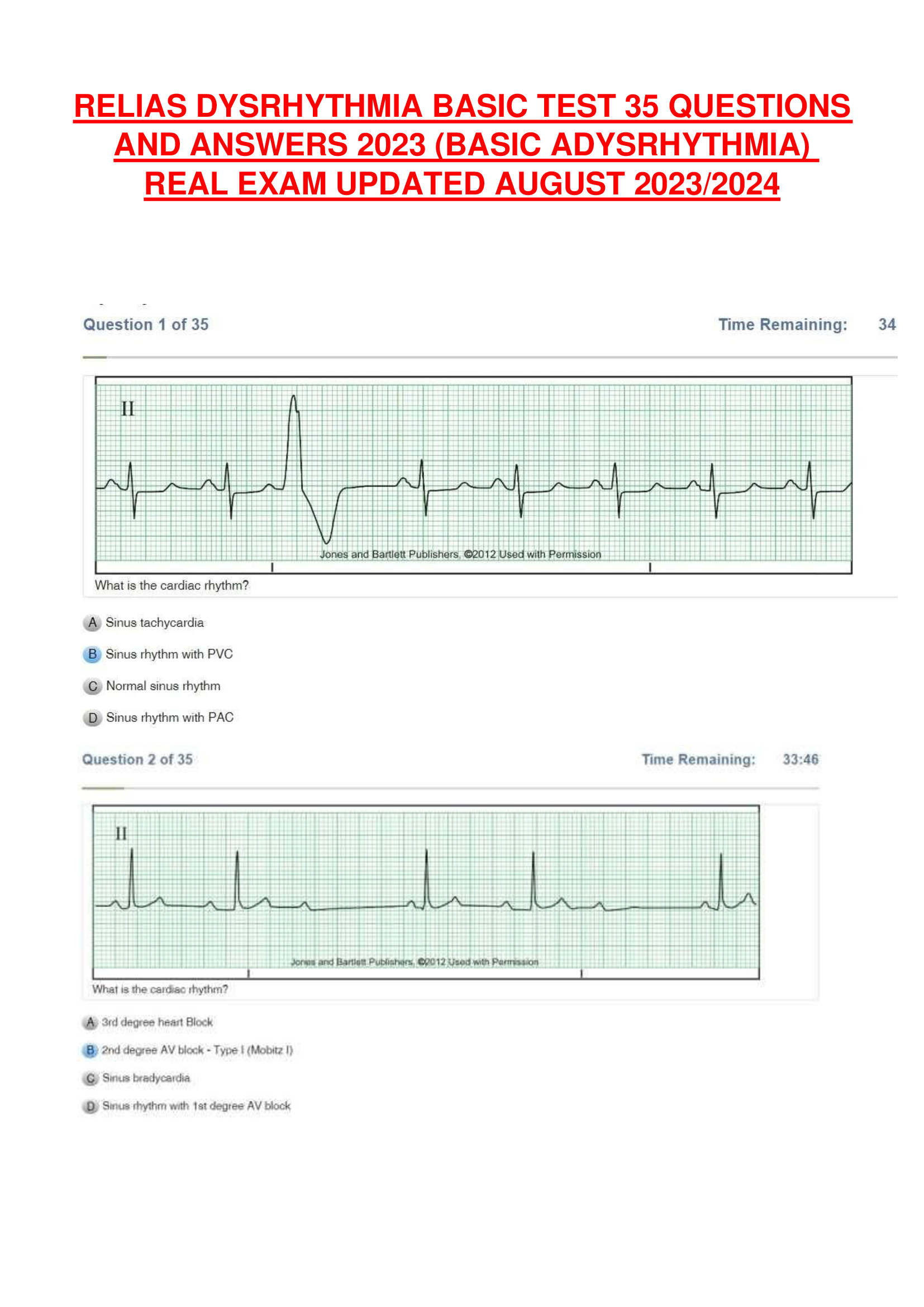RELIAS DYSRHYTHMIA BASIC TEST 35 QUESTIONS  AND ANSWERS 2023 (BASIC ADYSRHYTHMIA)  REAL EXAM UPDATED AUGUST 2023, 2024